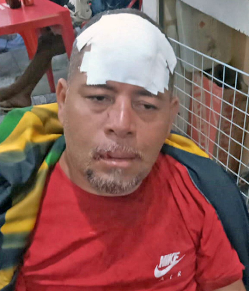 Morre homem ferido na cabeça após brigar com vizinho por causa de muro