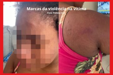 Patroa revela abuso a doméstica grávida e mostra mão inchada como prova de violência