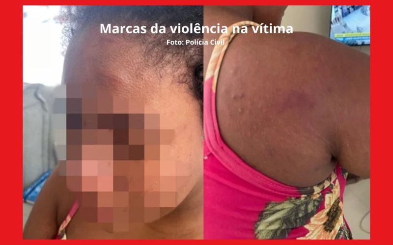 Patroa revela abuso a doméstica grávida e mostra mão inchada como prova de violência